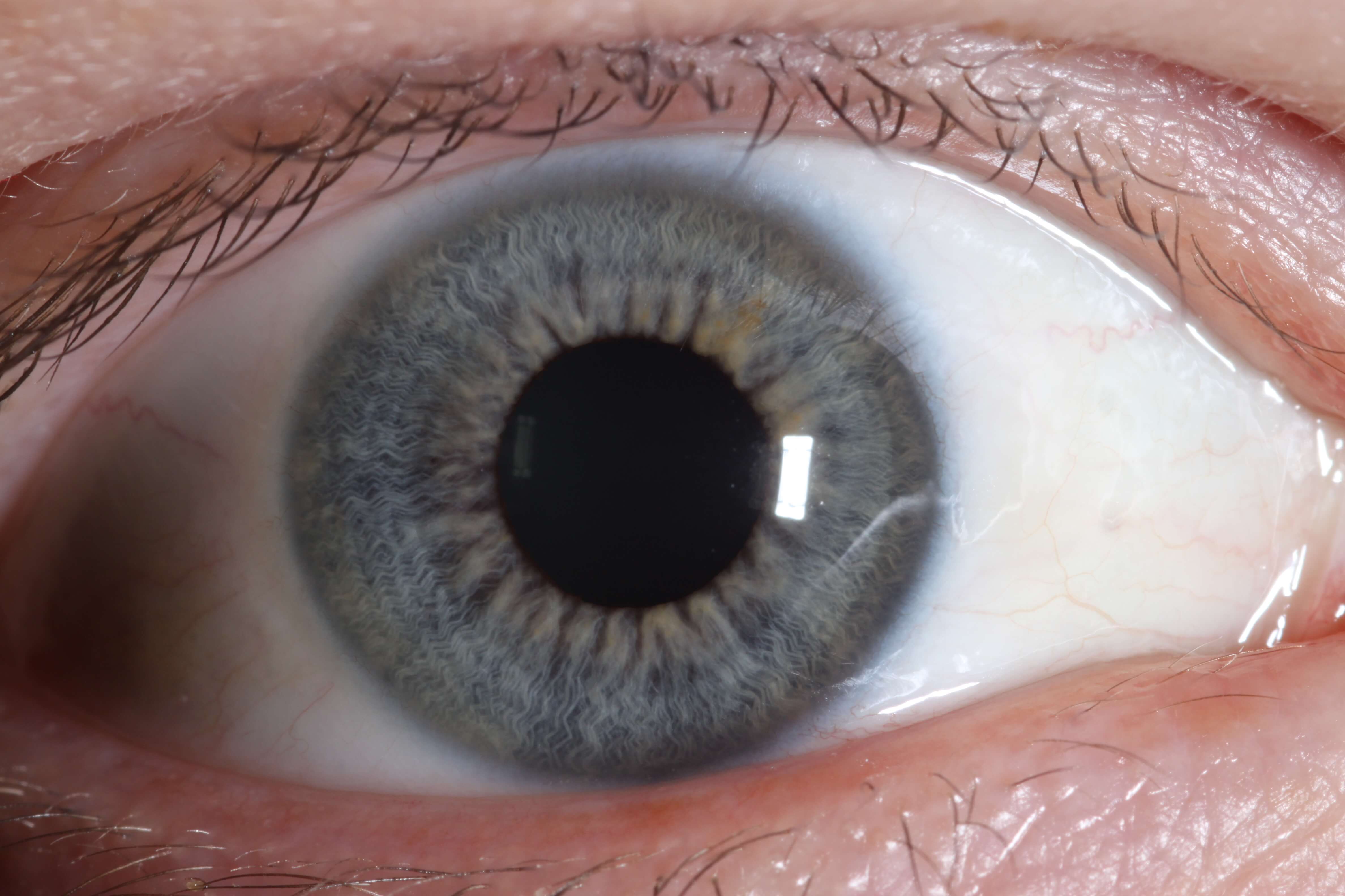 Irisdiagnose Naturheilpraxis Schmaußer